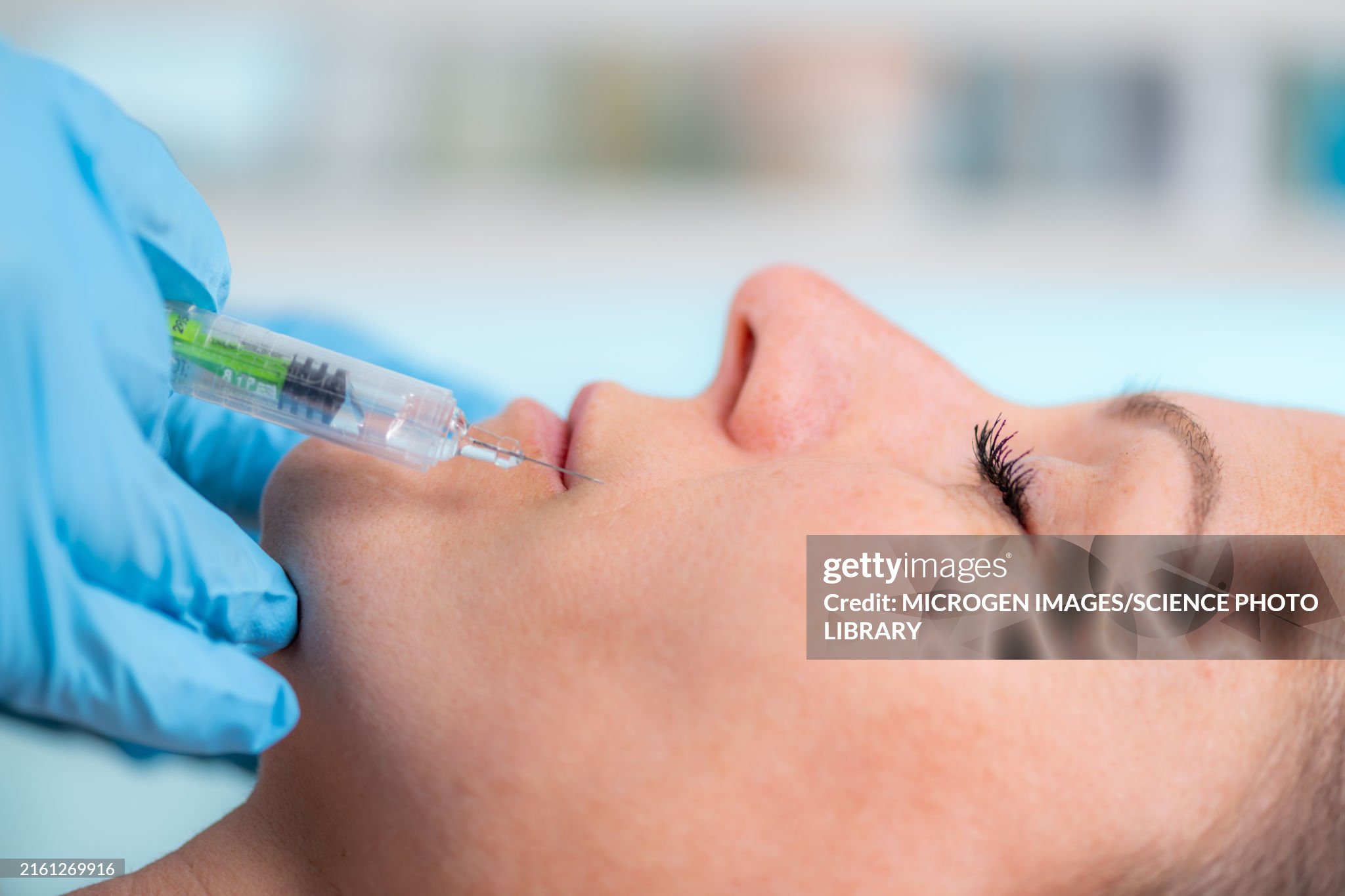 Dermal Filler