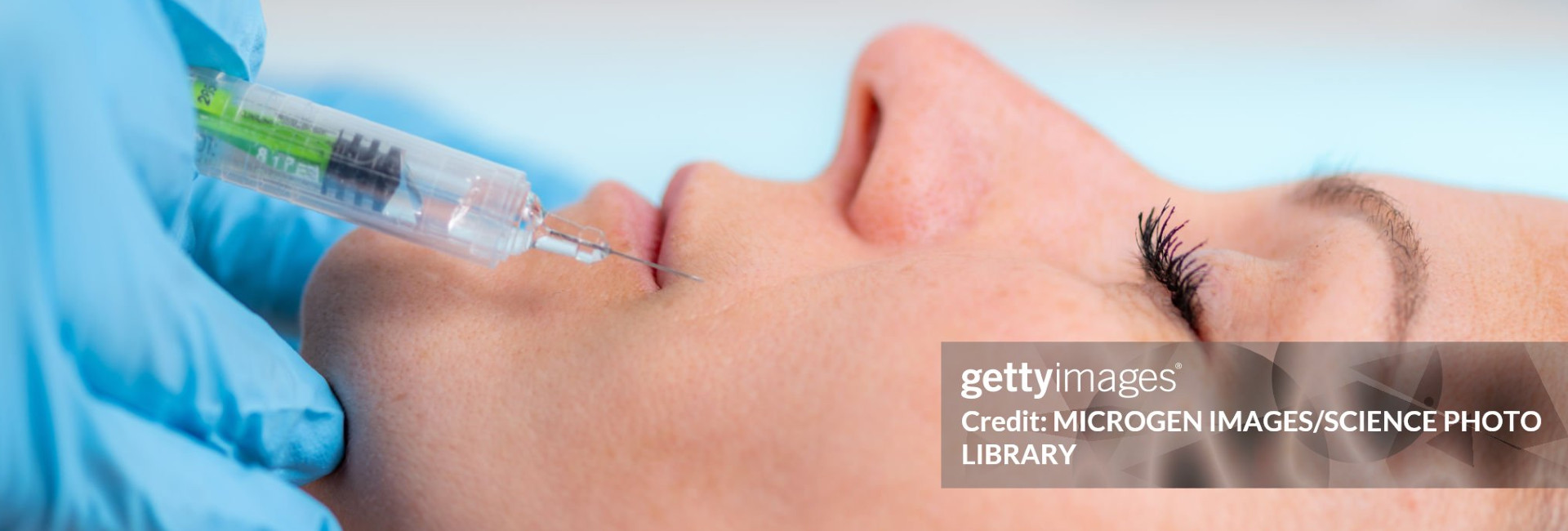 Dermal Filler